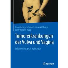 Springer Tumorerkrankungen der Vulva und Vagina