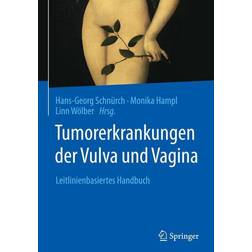 Springer Tumorerkrankungen der Vulva und Vagina